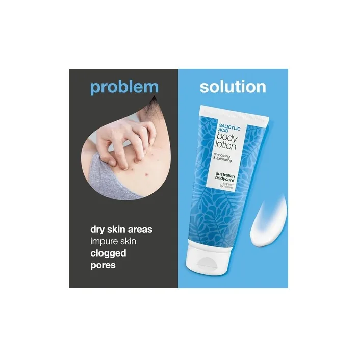 Body Lotion with Salicylic Acid 200ml for Blemishes, Dry and Oily Skin