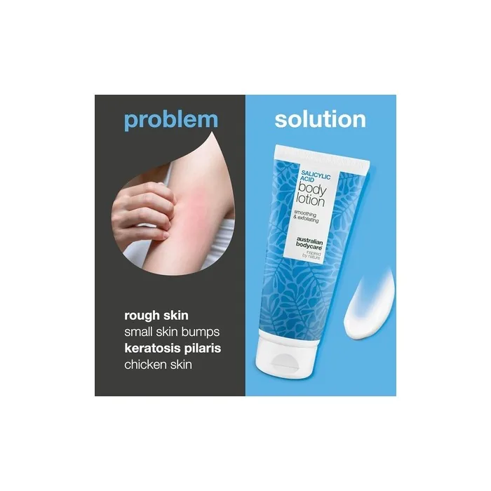 Keratosis Pilaris Body Lotion for Smooth Bumpy Skin