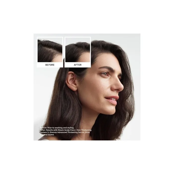 Nioxin Scalp Hair Thickening System Kit for Natural Colored and Damaged Hair