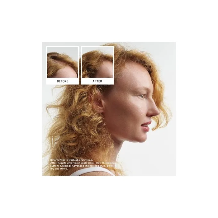 Nioxin Scalp Hair Thickening System Kit for Natural Colored and Damaged Hair
